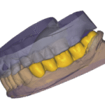 2025-02-04_00006-010-freeform-autosave.dentalCADscreenshot