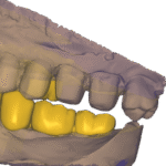 2025-02-23_00006-011.dentalCADscreenshot