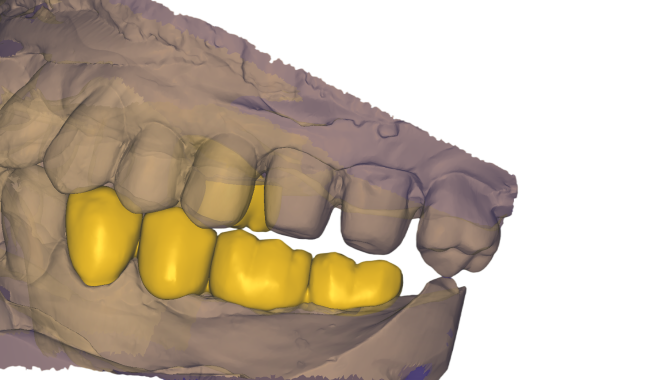 2025-02-23_00006-011.dentalCADscreenshot