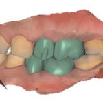 2025-05-19_00020-001_DentalCadScreenshot