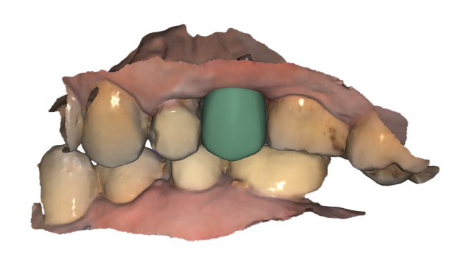 crown 3