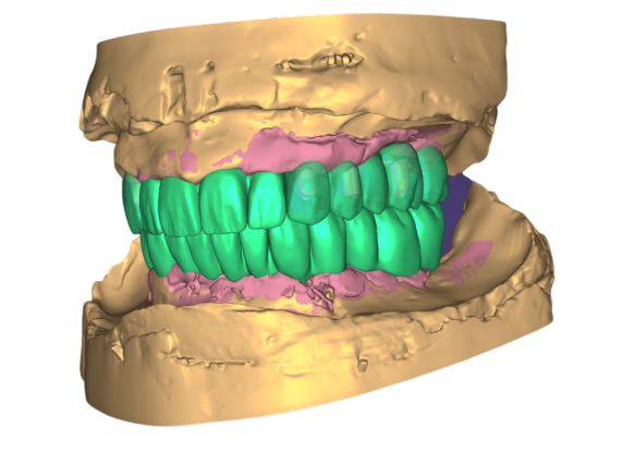 full mouth 2